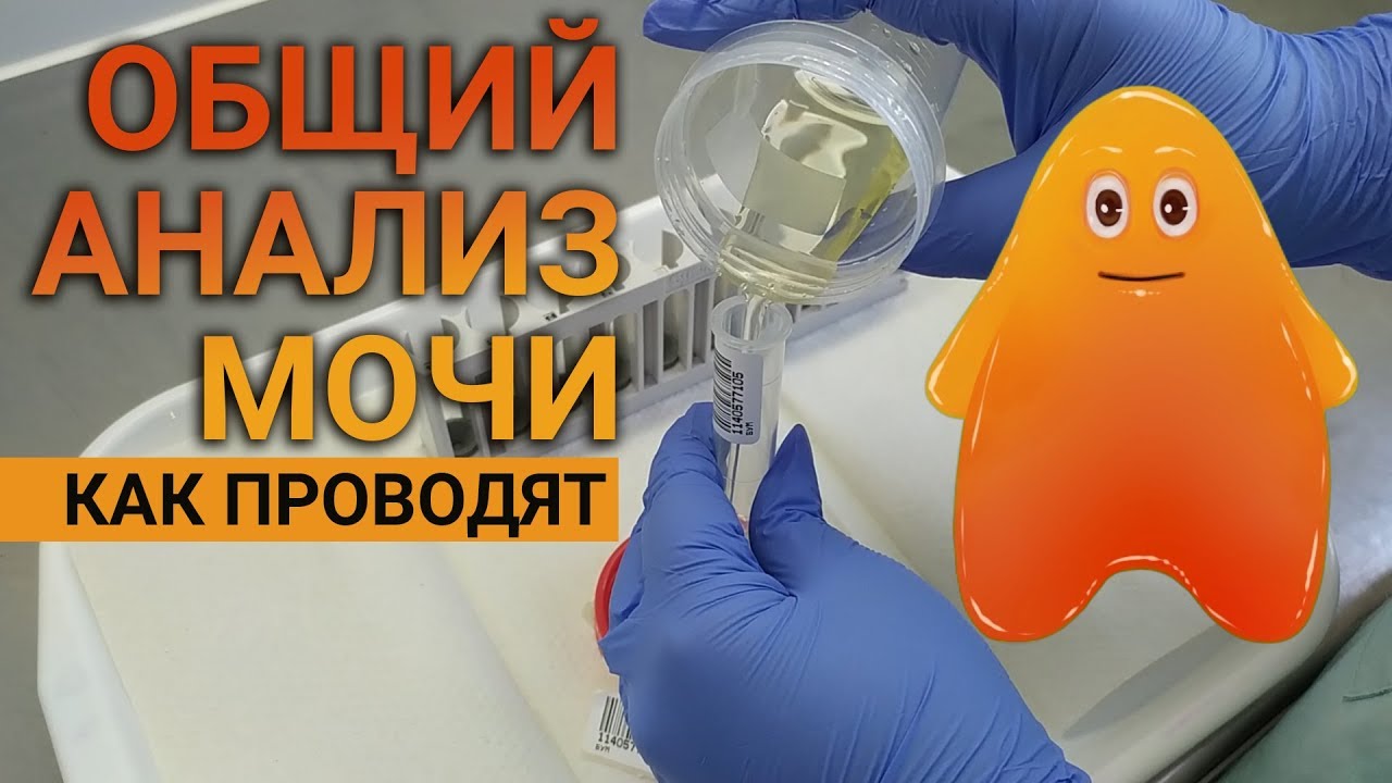 Как выполняется общий анализ мочи в лаборатории.