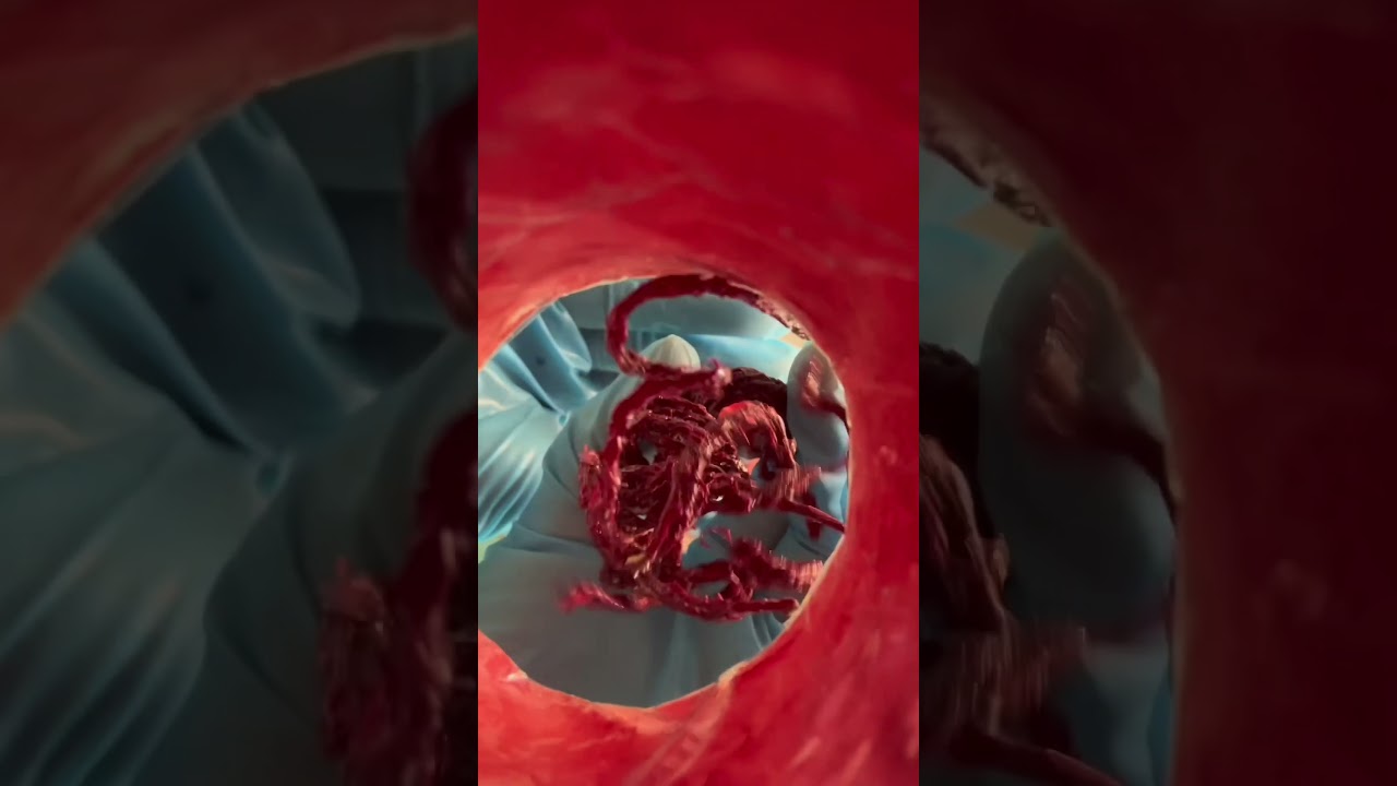 ASMR - Te cambio el ojo en 1 minuto #asmr #asmrroleplay #medicalasmr