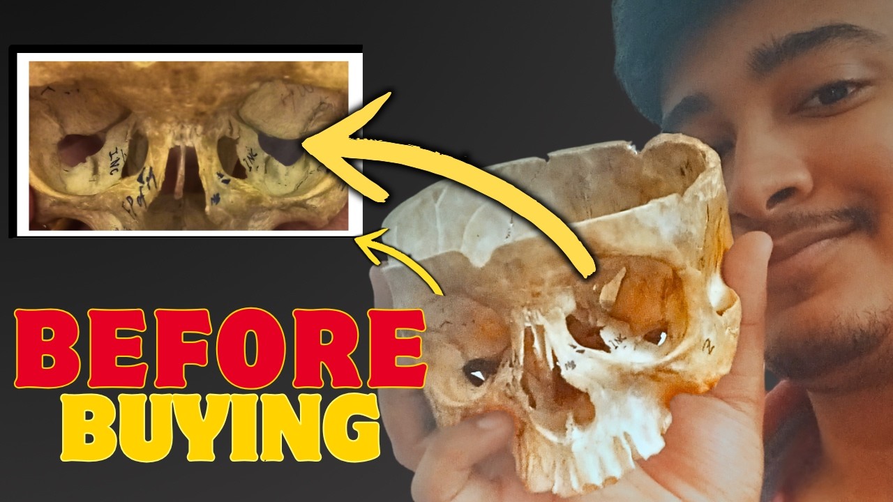 Complete Bone Set Guide for MBBS 1st Year | How to Buy & Where to Buy Boneset | Anatomy Explained 💀