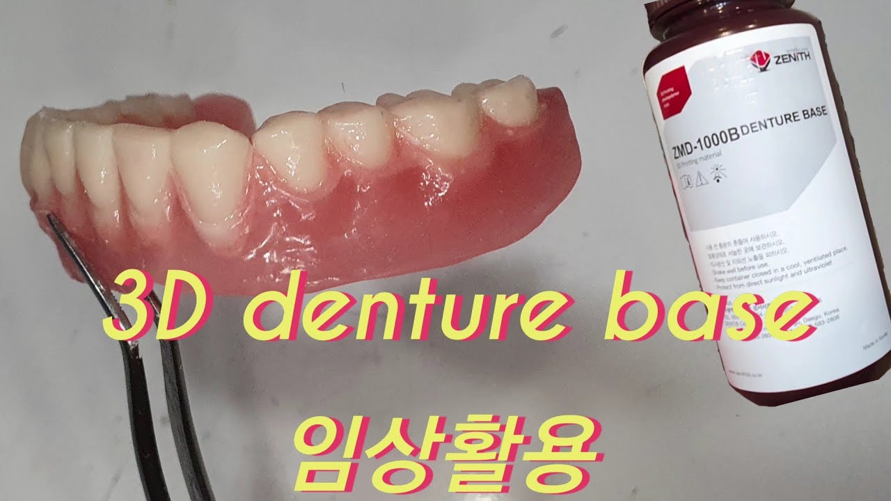 3D denture base 임상활용