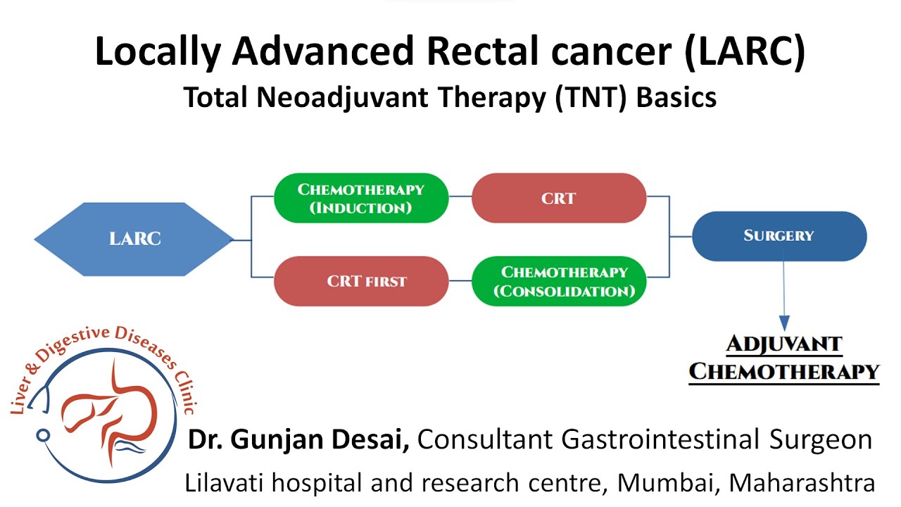 Locally advanced rectal cancer & total neoadjuvant therapy - Induction vs consolidation chemotherapy