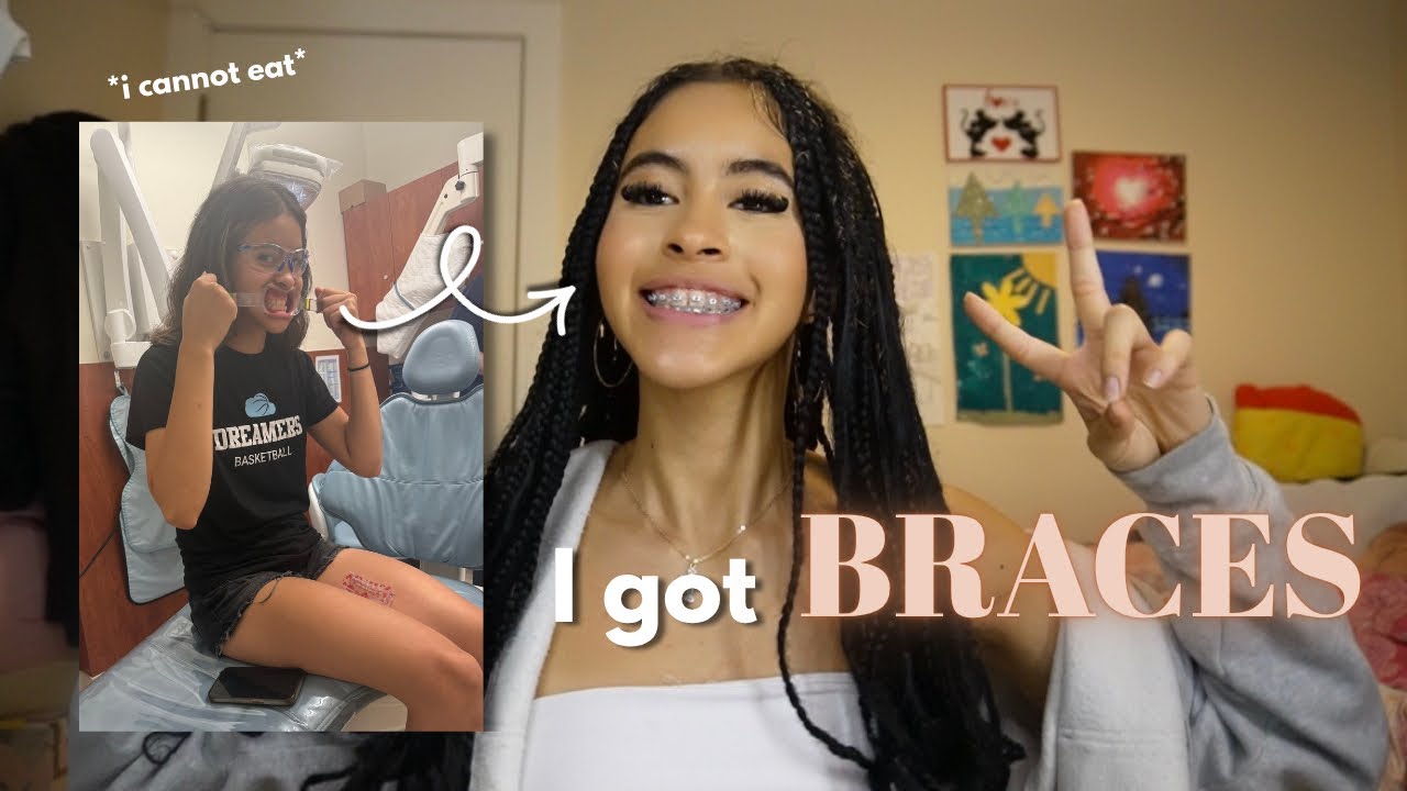 COME GET MY BRACES WITH ME !! ( my experience + what to expect ) 🦷🫧