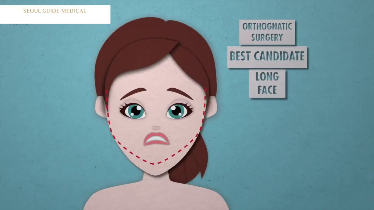 Контурная пластика лица против челюстной пластики: в чем разница | Seoul Guide Medical