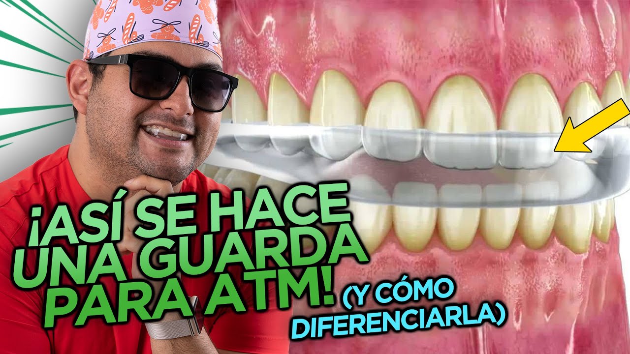 ¡COMO QUITAR UN TRASTORNO DE LA MANDIBULA, DOLOR, CHASQUIDO CON UN GUARDA HECHO CORRECTAMENTE! ❤️