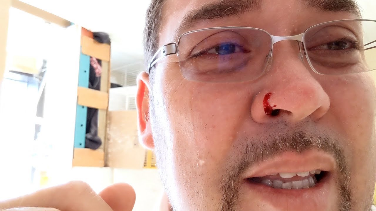 Comment réagir face à l'attaque d'un perroquet - How to react to a parrot attack