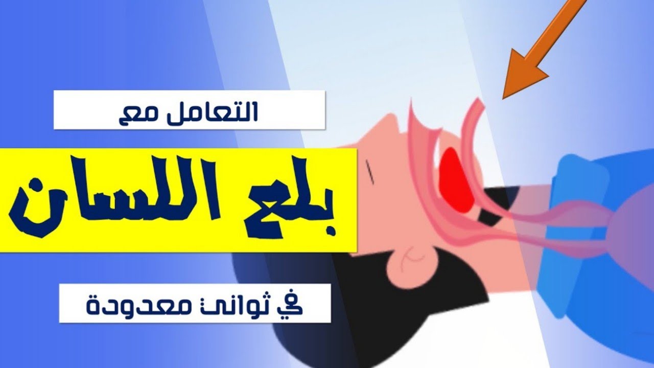 إسعاف بلع اللسان