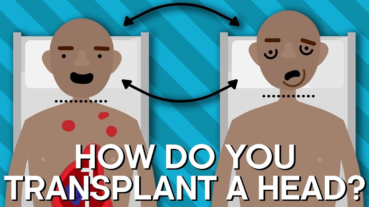 How Do You Transplant A Human Head? | Earth Science