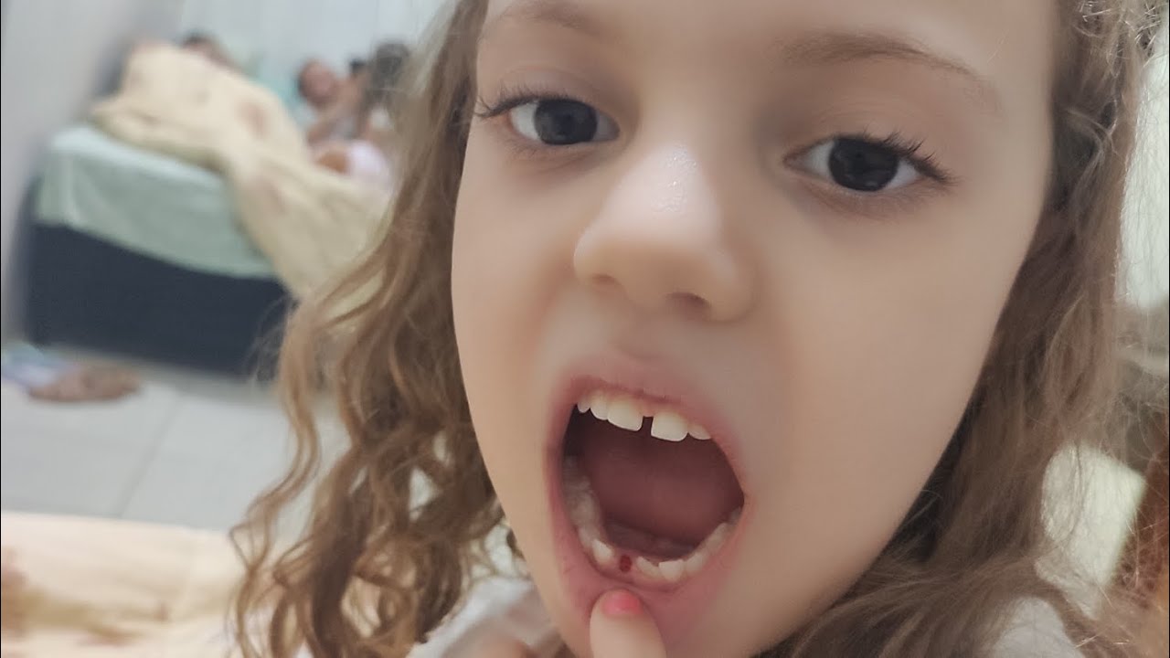 Tirando o dente 🦷