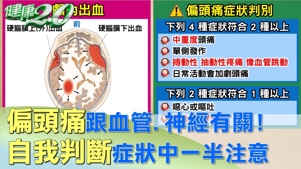 偏頭痛跟血管.神經有關！自我判斷症狀中一半注意 健康2.0