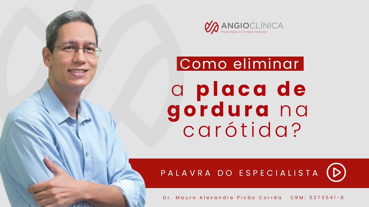 Como eliminar a placa de gordura na car&oacute;tida?