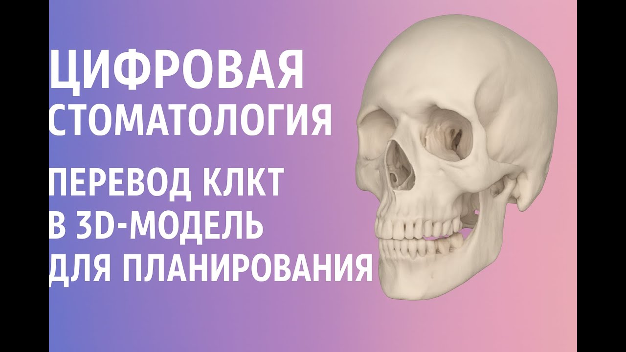 Цифровая стоматология: перевод КЛКТ в 3D-модель для планирования