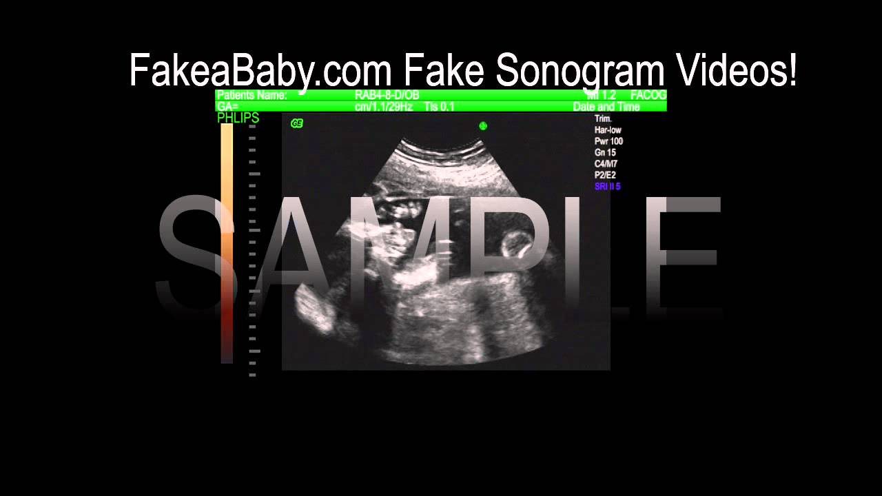 Fake Sonogram Video Sample