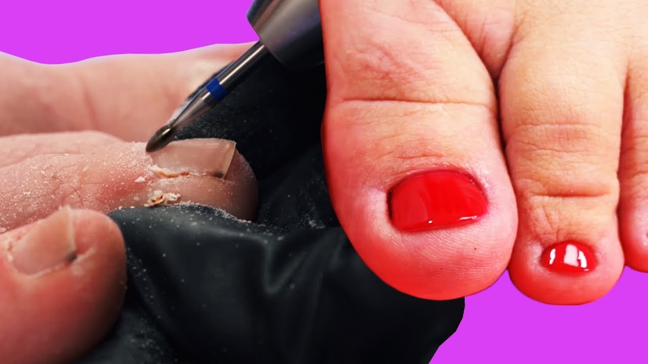 MOST AMAZING & SATISFYING TOENAIL TRANSFORMATIONS - COMPILATION