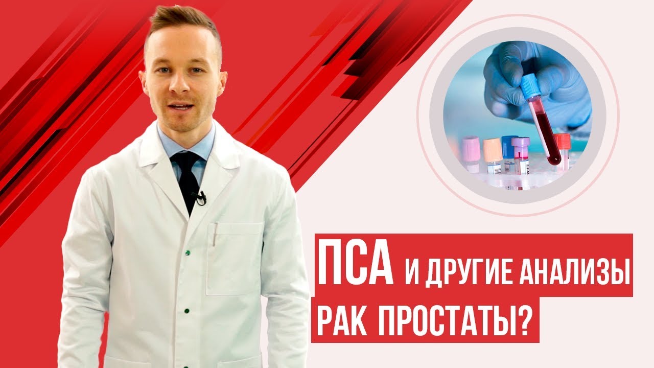 ПСА и другие способы диагностики рака простаты. ПСА норма.