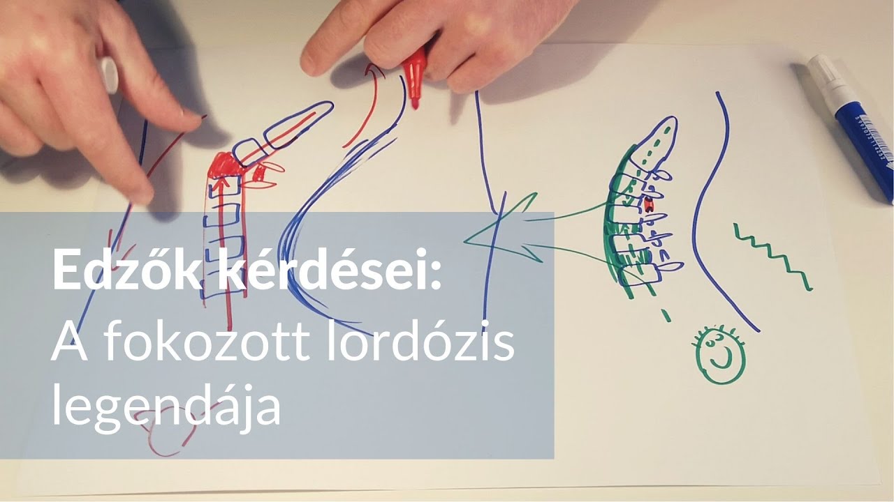 A fokozott lordózis legendája