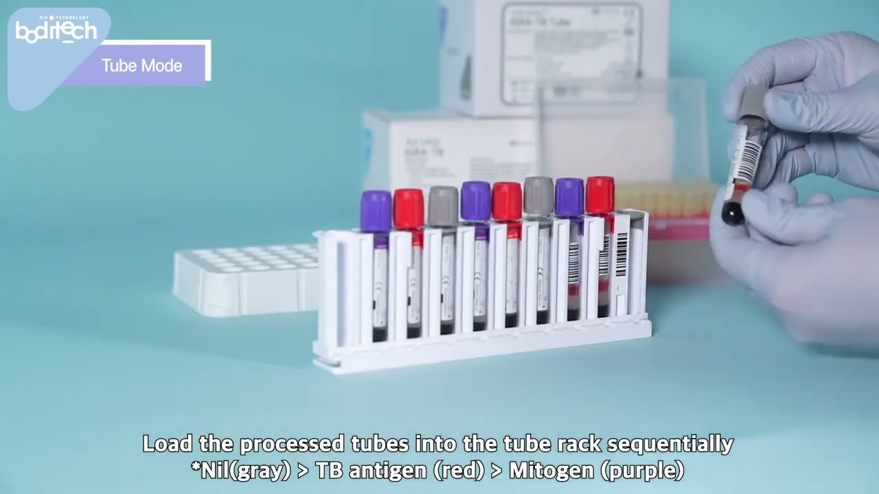 IGRA-TB with AFIAS-10