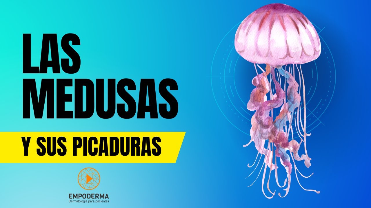 LAS MEDUSAS Y SUS PICADURAS | ¿Qué hacer si pica?