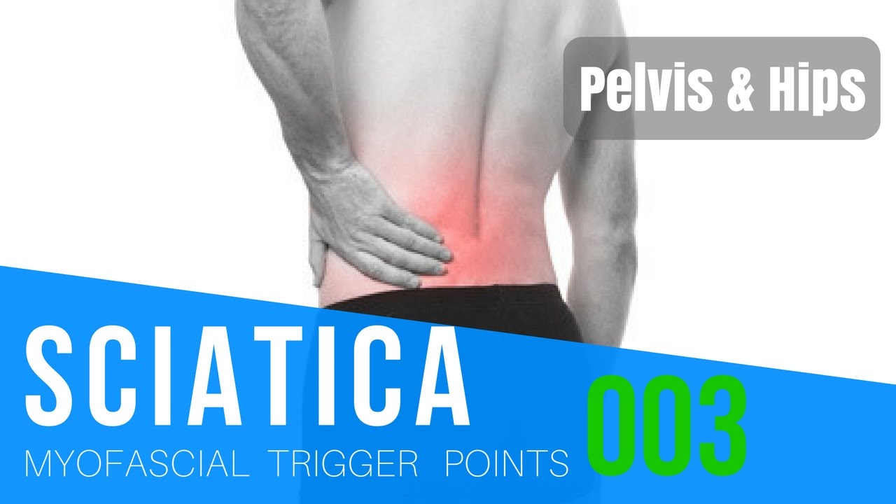Sciatica Pain 003: Relieve Myofascial Trigger Points in the Pelvis and Hips