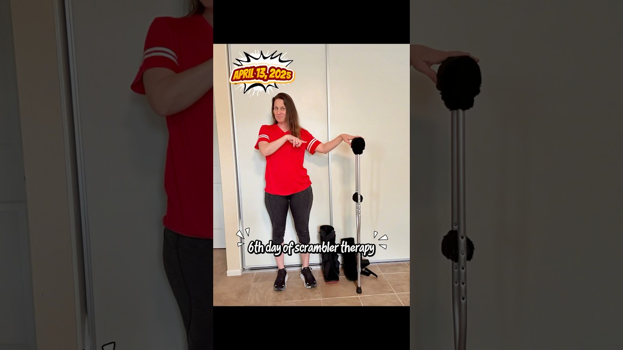 Sandra’s successful journey with Calmare Scrambler Therapy to battle CRPS and gain back her life!