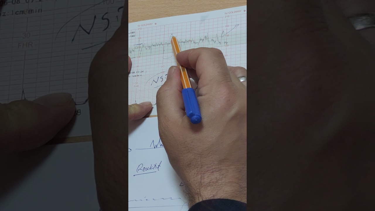 NST'DE FETÜS SIKINTI DA Mİ? NE ZAMAN SEZARYEN GEREKLİDİR?