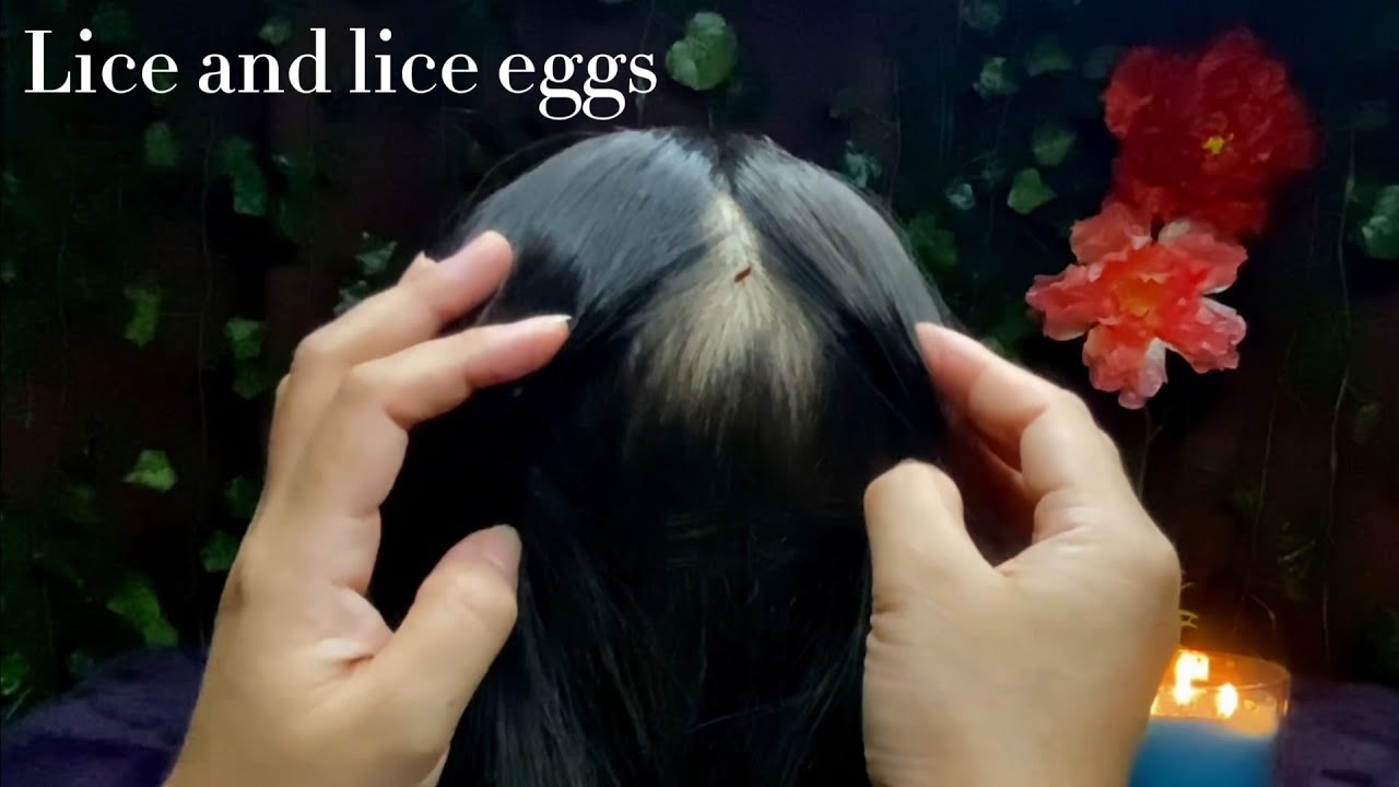ASMR Soothing Remove Lice and Lice Eggs | No Talking 😴💤🥱
