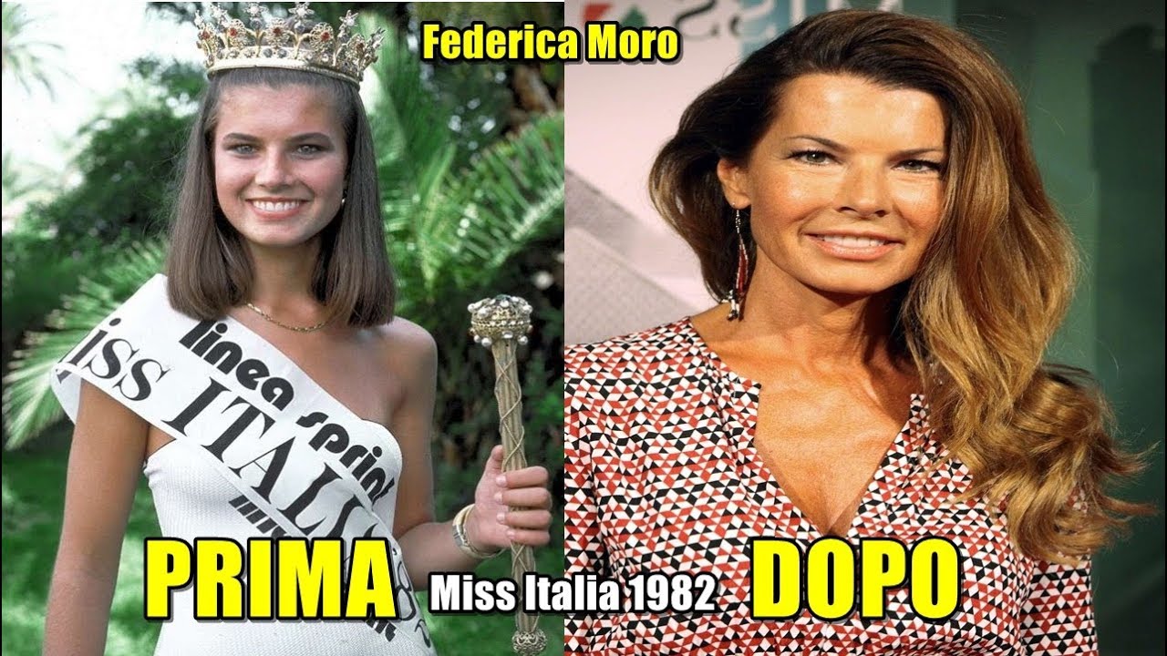 MISS ITALIA & PRIMA E DOPO 2018