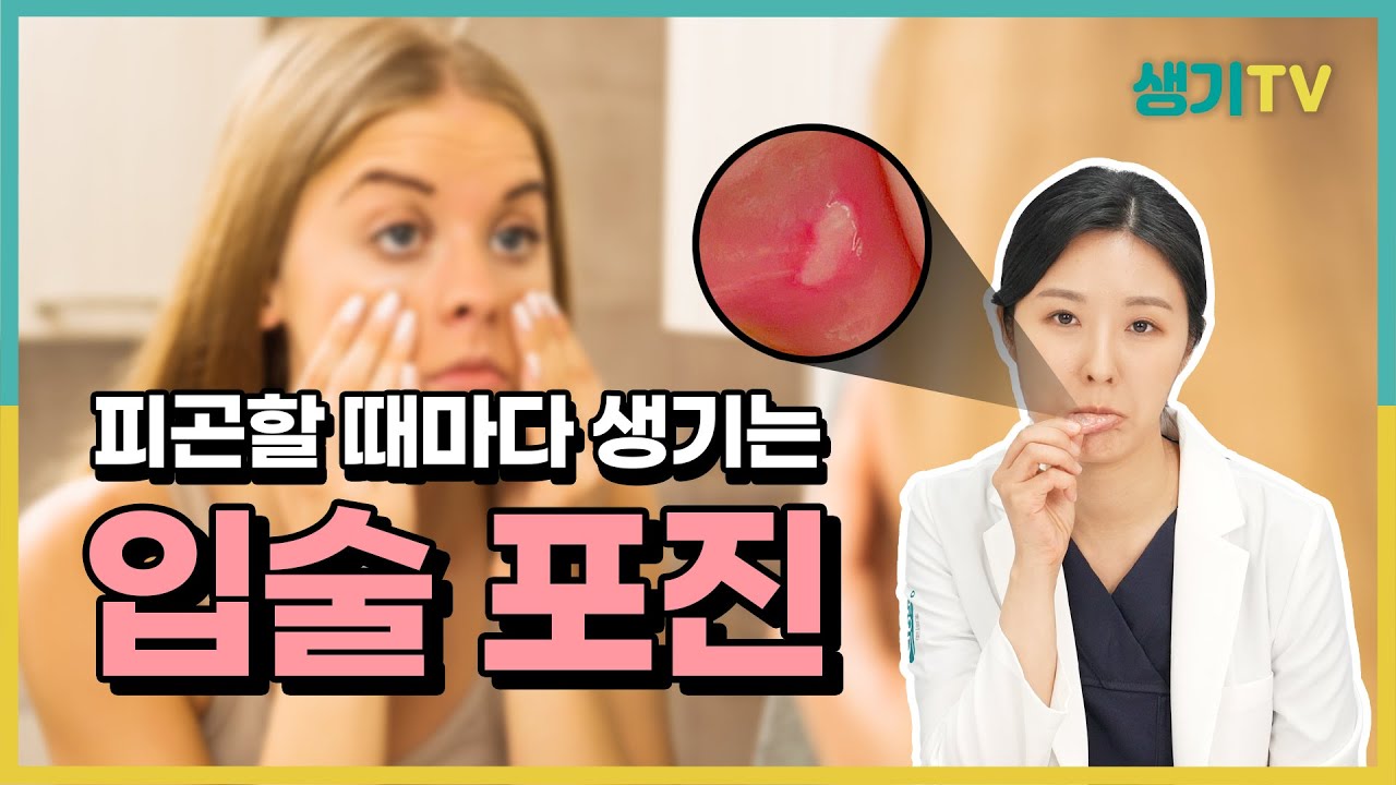 헤르페스 입술포진 빨리 낫는법