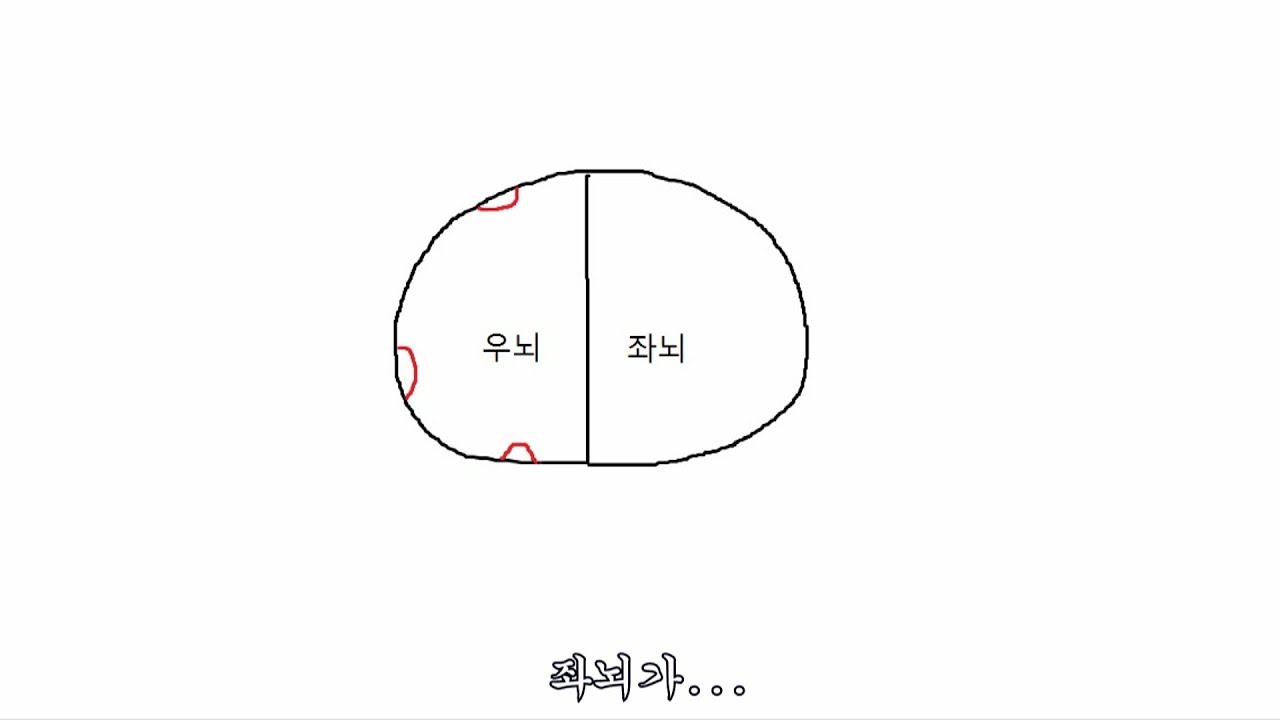 뇌에 문제가 생긴 사건 정리 [재업]