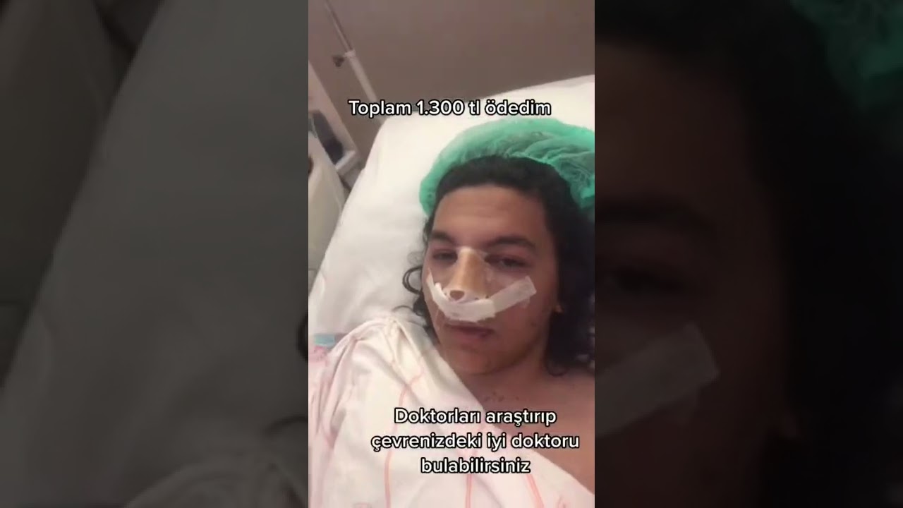 1500 tlye devlette burun estetiği olunur mu?