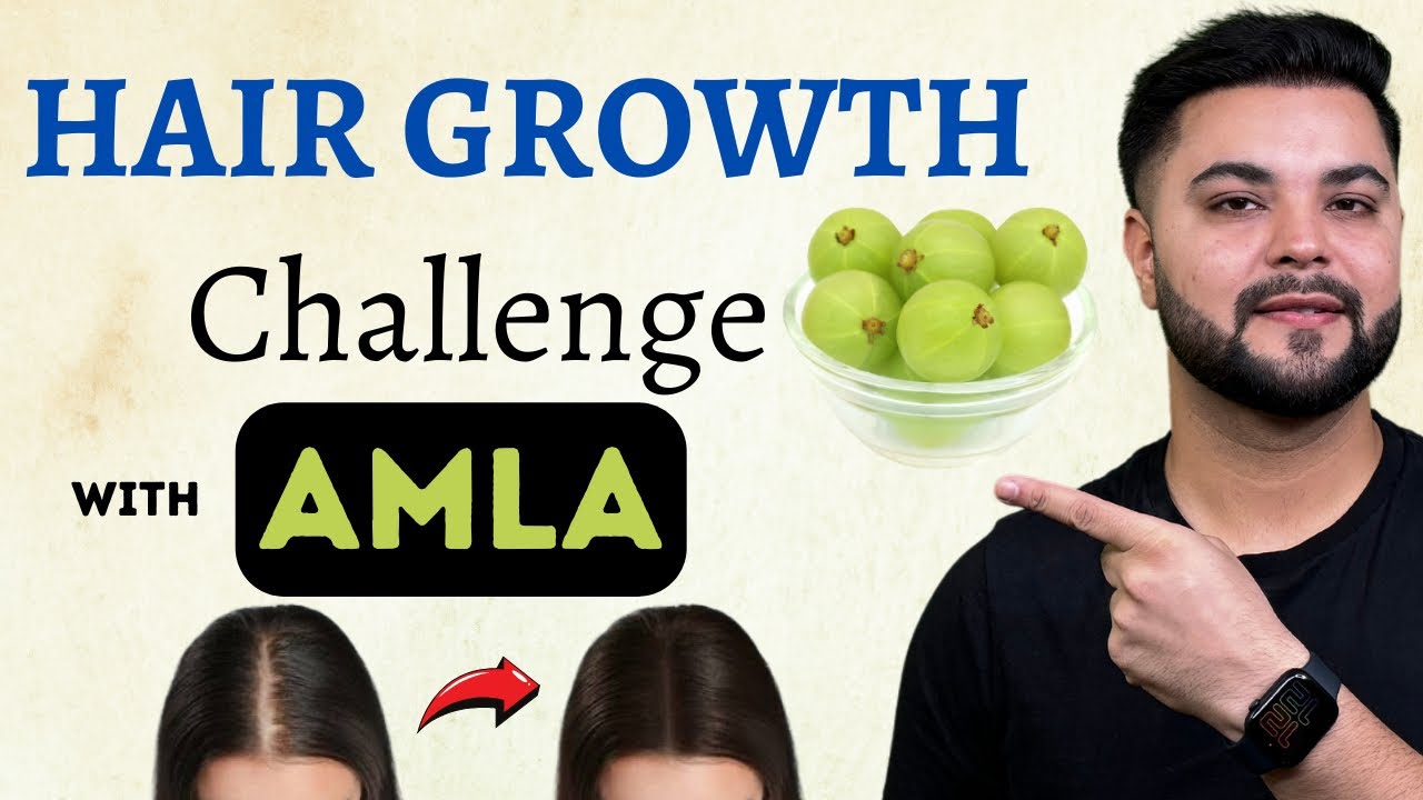 14 Days Hair Growth Challenge: Amla to Stop Hair Loss & Reverse Premature Greying