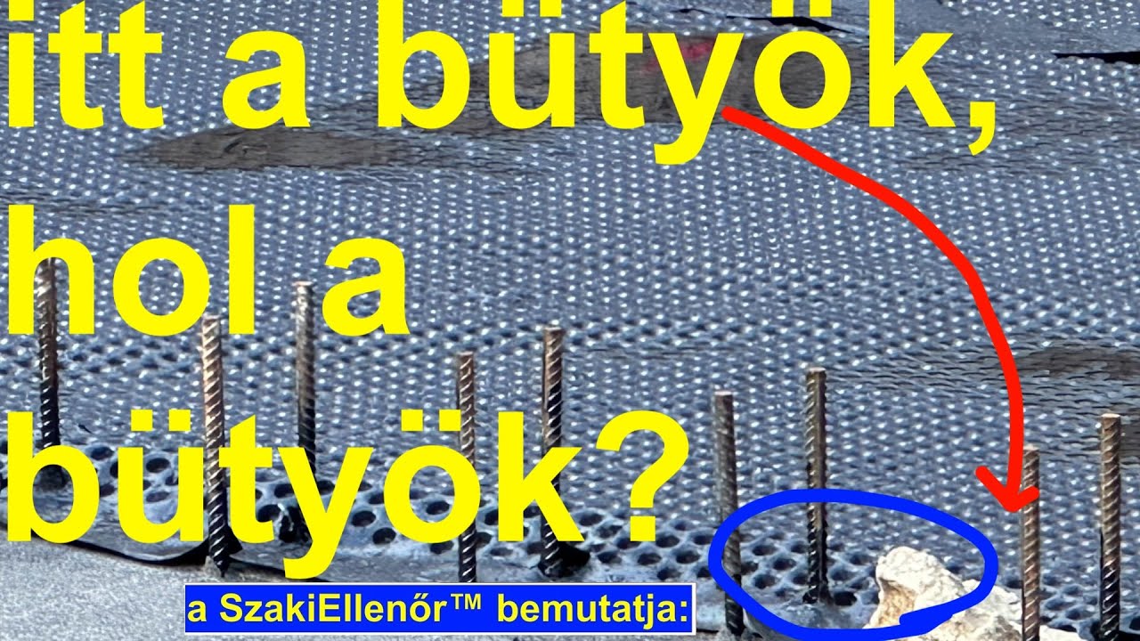 Hogyan álljon a bütyök? Befele? Kifele? Megosztó téma, pedig nem lenne bonyolult!