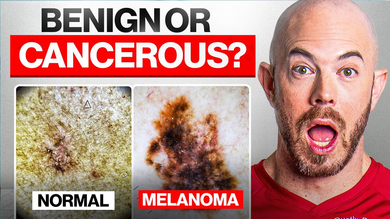 Is This Skin Cancer? Real Cases from a Dermatologist's Camera