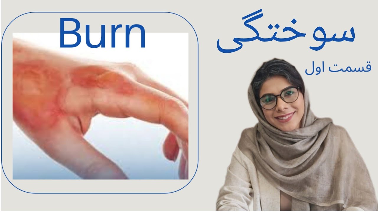 هر آنچه درباره سوختگی باید بدانیم.. قسمت اول