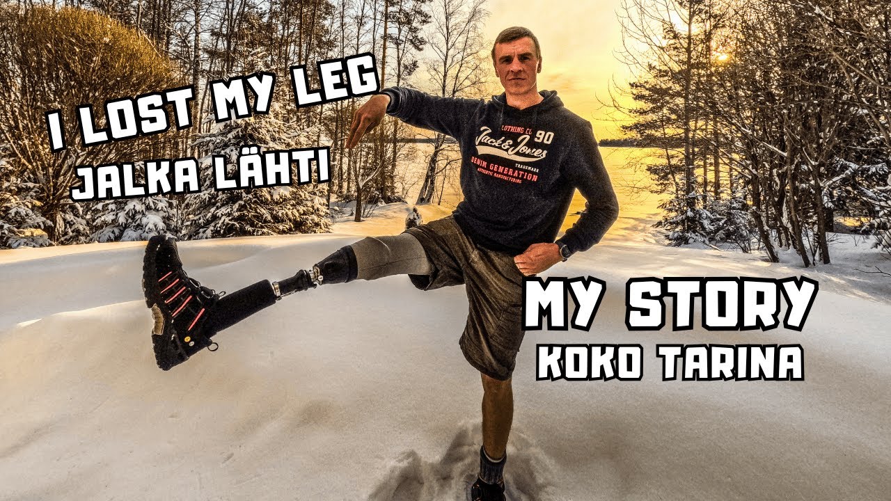 Jalan tarina: Miten menetin jalkani || I Lost My Leg – My Story