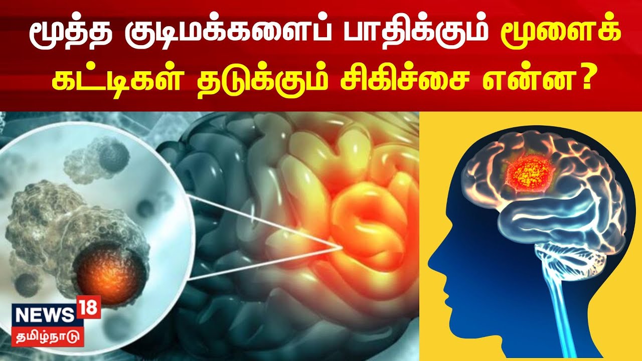 Apollo Proton Cancer Center | மூத்த குடிமக்களைப் பாதிக்கும் மூளைக் கட்டிகள் தடுக்கும் சிகிச்சை என்ன?