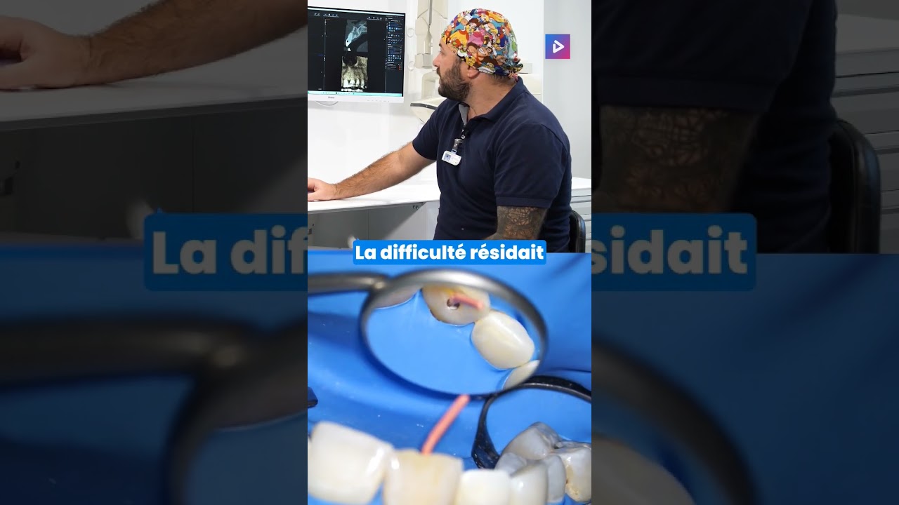 ENDODONTIE GUID&Eacute;E : L&rsquo;&eacute;volution de la prise en charge des parodontites apicales aigu&euml;s 🦷