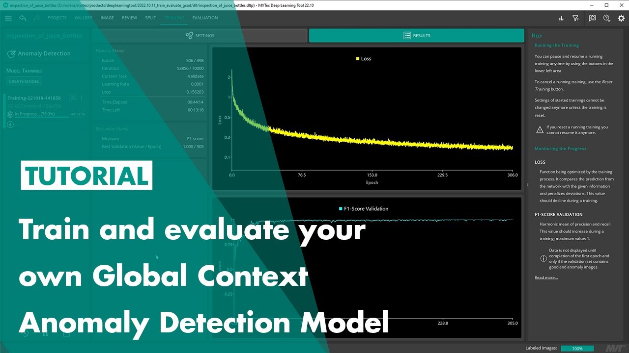 How to train and evaluate a Global Context Anomaly Detection Model with the MVTec Deep Learning Tool