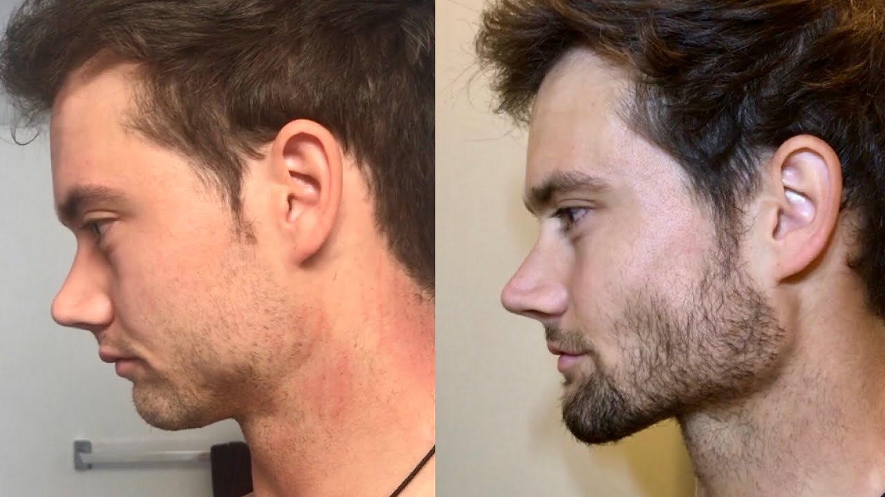 30 Day Face Transformation (Mewing + Fasting) | Connor Murphy