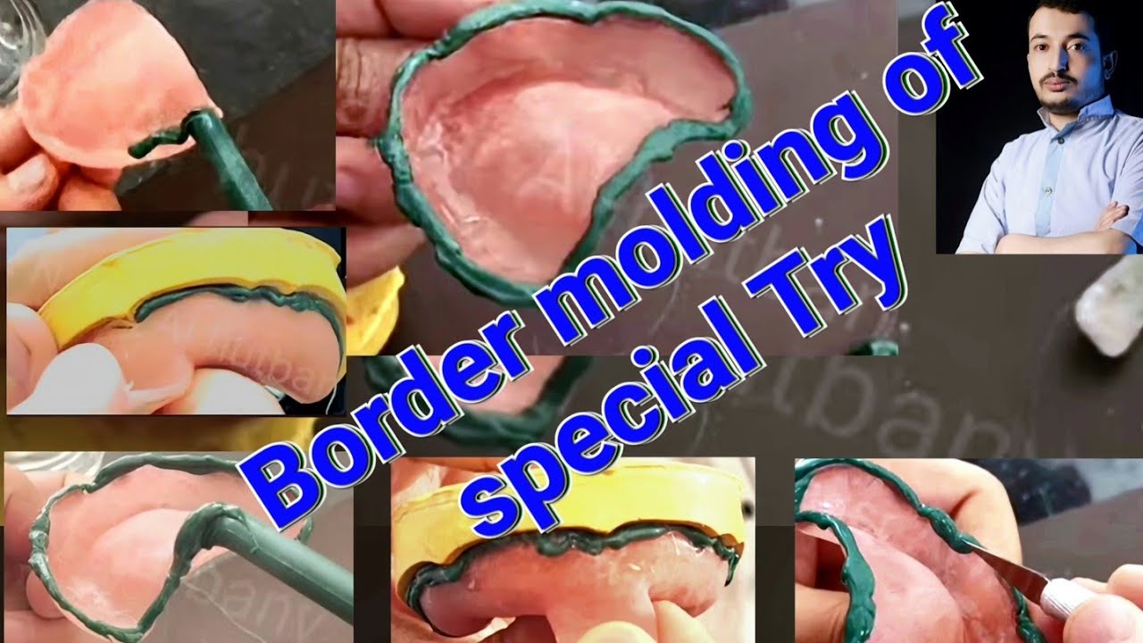 Border molding of maxillary special tray #dentalstudent #dentistry #prosthodontics #preclinical