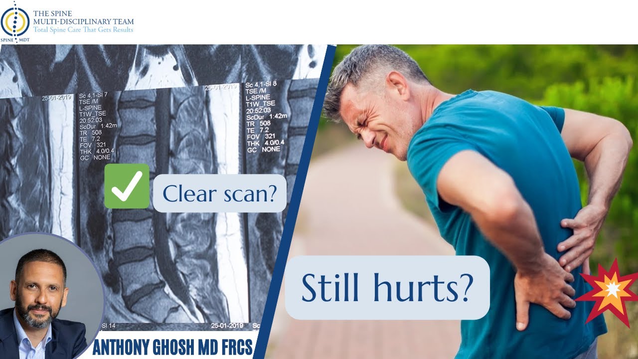 Back pain is NOT All in Your Head: Understanding the Biopsychosocial Model