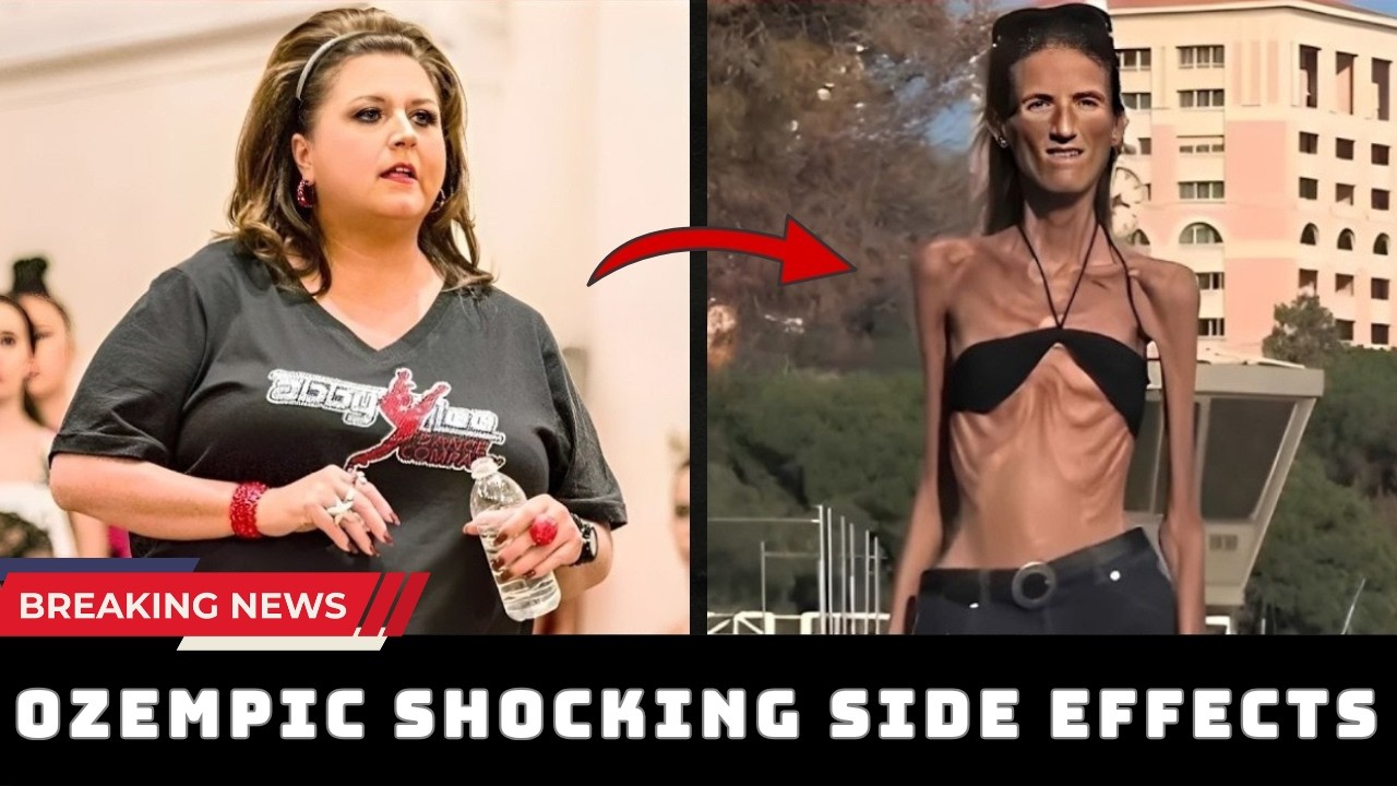 35 Ozempic Face Before & After 2026 | Celeb Weight Loss, Side Effects, Transformations #2