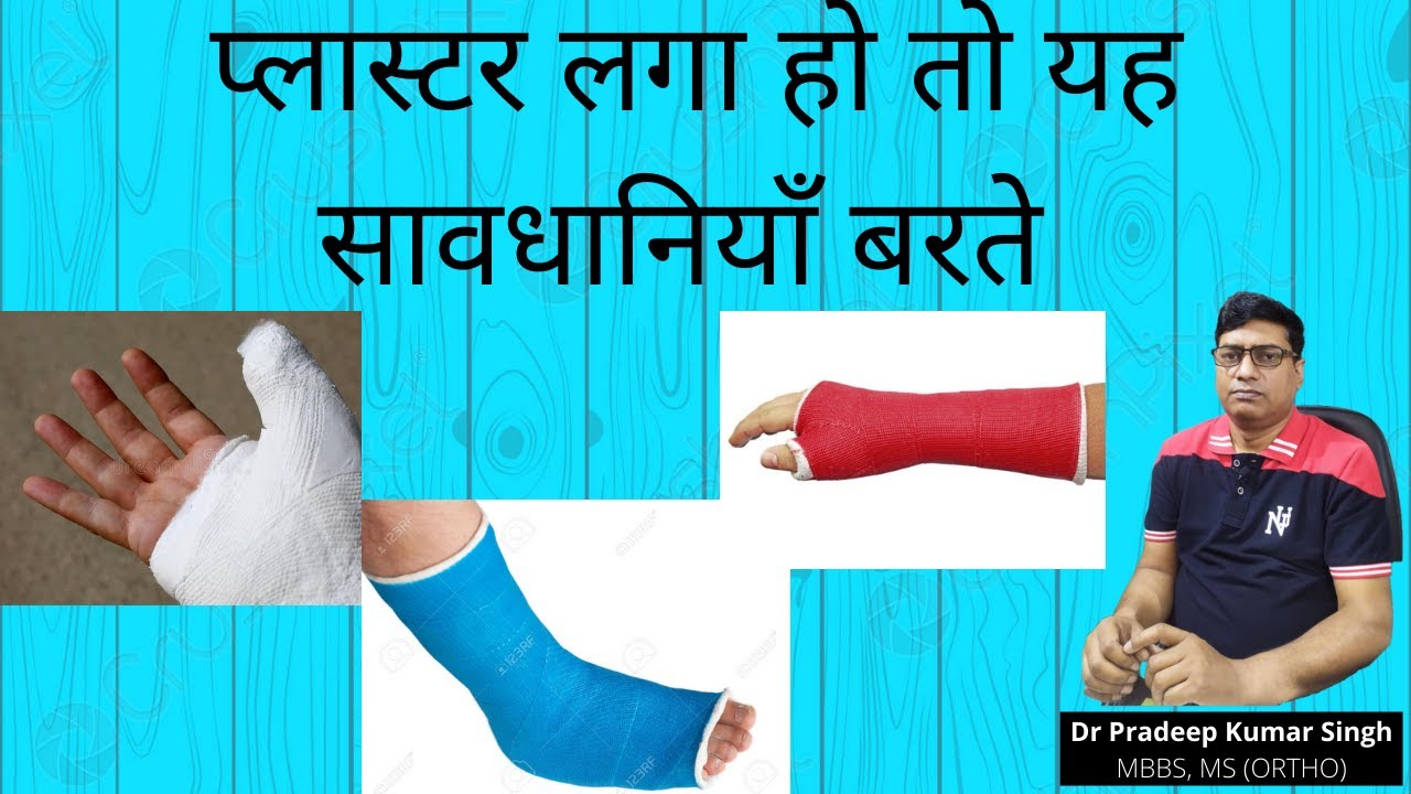 प्लास्टर लगा हो तो यह सावधानियाँ बरते/Precaution in plaster /Dr Pradeep Kumar Singh