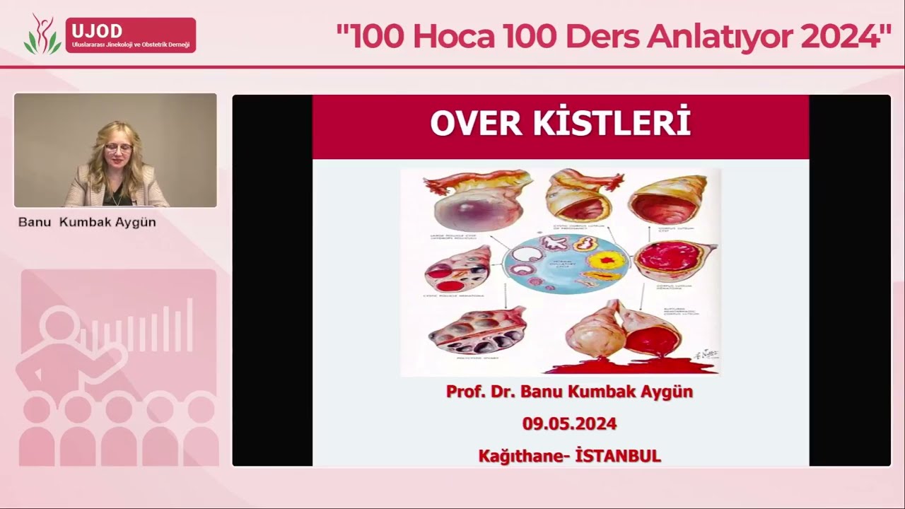 Over Kistleri - Prof. Dr. Banu Kumbak Aygün