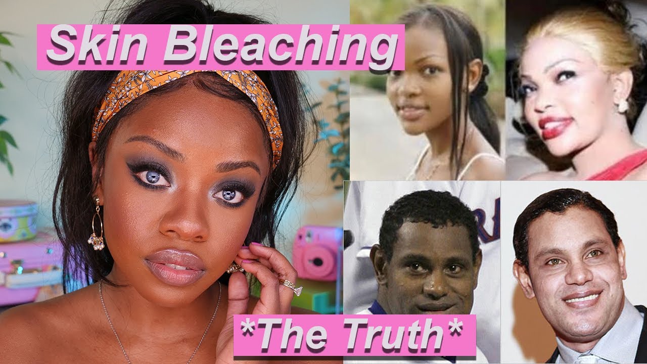 Why would anyone do this? Skin Bleaching & Beauty Standards *The TRUTH*
