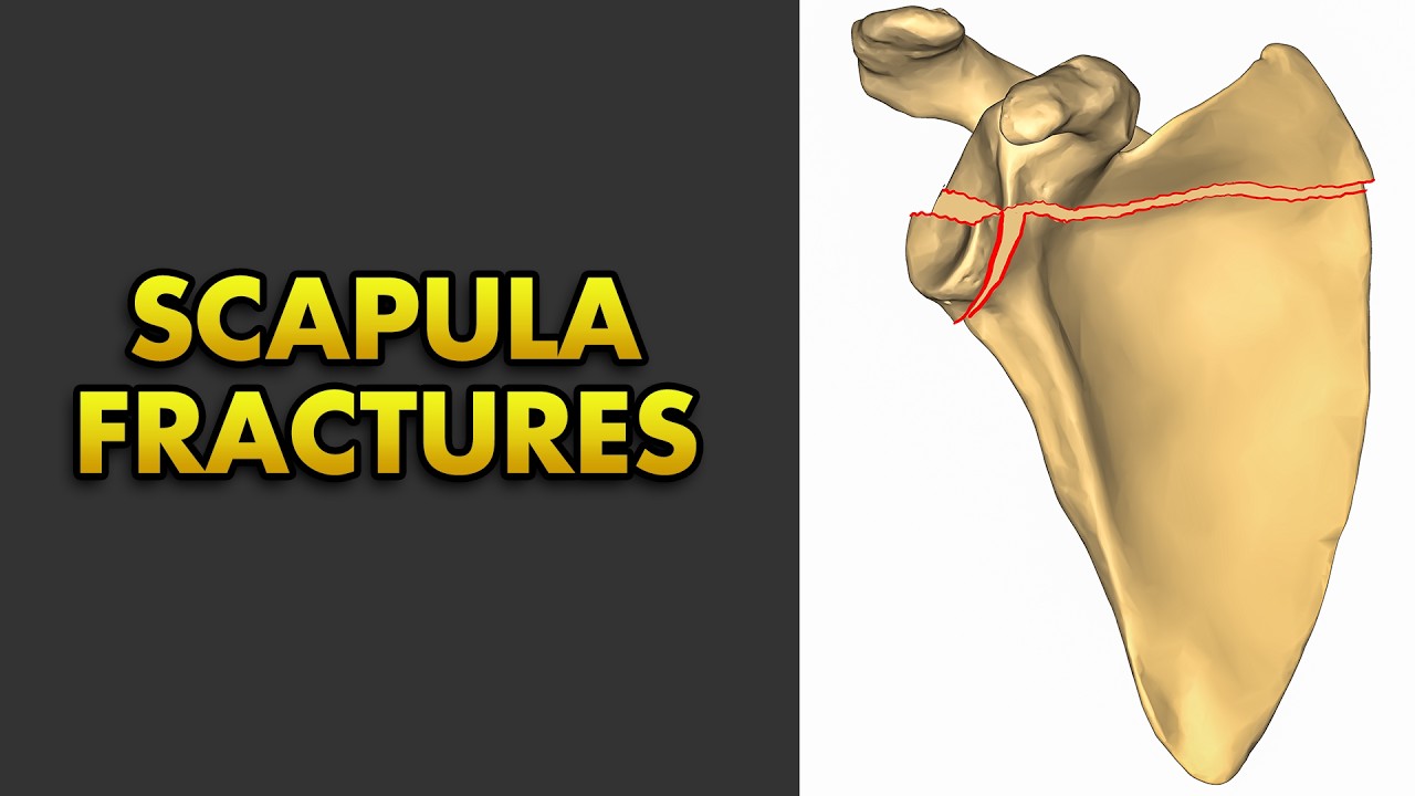 Scapula Bone Fractures: Anatomy, Classification, Clinical Features and Treatment