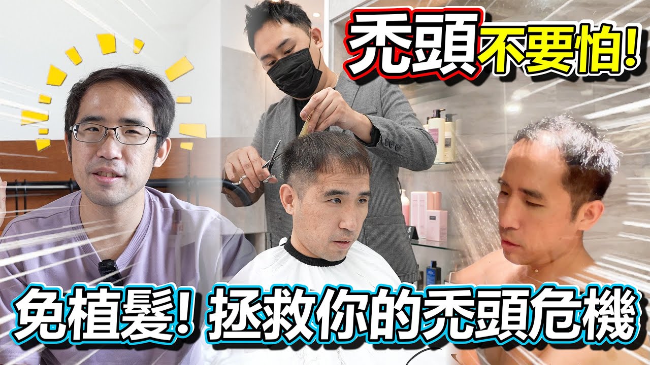搶救禿頭大作戰 終於有植髮以外的方法了 只要跟我一起這樣做 帶你回復往日型男！