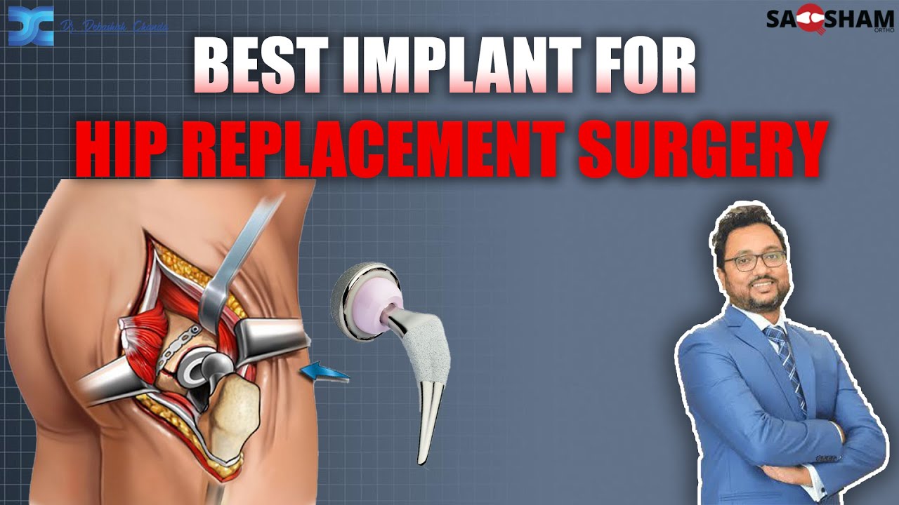 Best Implant for Hip Replacement Surgery: A Comprehensive Guide | Dr. Debashish Chanda
