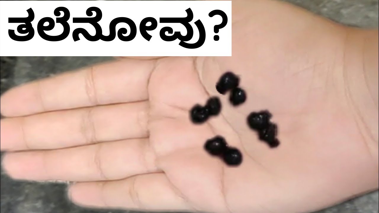 4 ಕಾಳು ಸಾಕು ತಲೆನೋವು 2 ನಿಮಿಷಗಳಲ್ಲಿ ಮಾಯ Home Remedies for Headache kannada