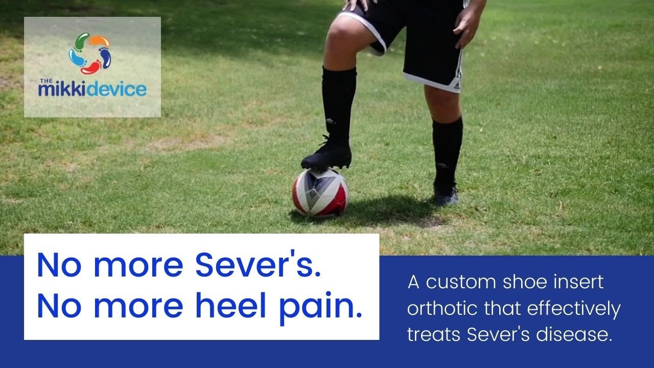 Jackson's Mikki Device Testimonial - No More Heel Pain or Sever's