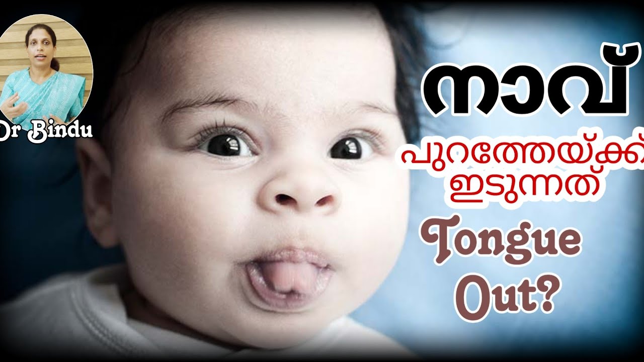 നാവ് എപ്പോളും പുറത്തേയ്ക്കിടുന്നത് ചിലപ്പോൾ ചില രോഗം കൊണ്ടാകാം/Protruded tongue in children/DrBindu